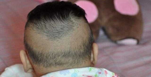 营养物质|新生儿头发稀少只因遗传?做好这5点宝宝头发浓又密,赶紧学起来