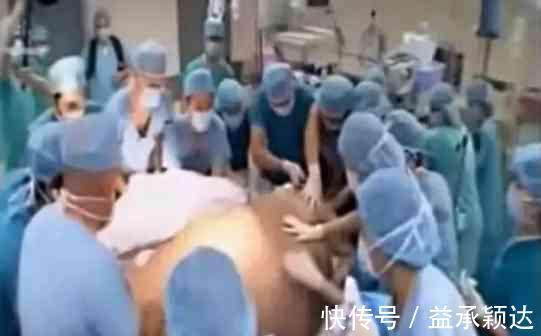 女子|印度一女子一胎怀了11个婴儿,不得已医院安排多位医生为其接生