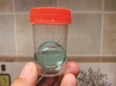 婴儿|婴儿误吞水宝宝 引发肠梗阻呕吐不止