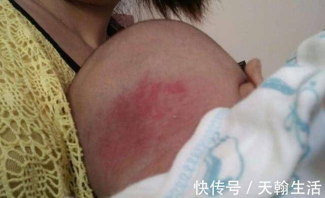 怀孕期间|怀孕后，孕妈最好避免做这4件事，不然胎儿容易长“胎记”