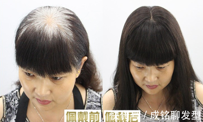 假发片 40岁头顶的头发都白了,不想染发,有啥好办法让白发变黑发吗?