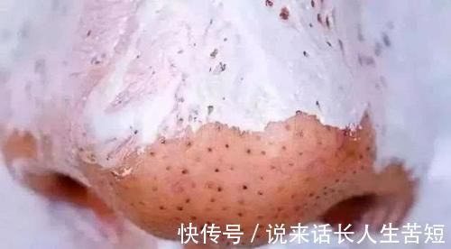 黑头|女生鼻子上“黑头泛滥”，坚持这3个好习惯，鼻子会越来越白净