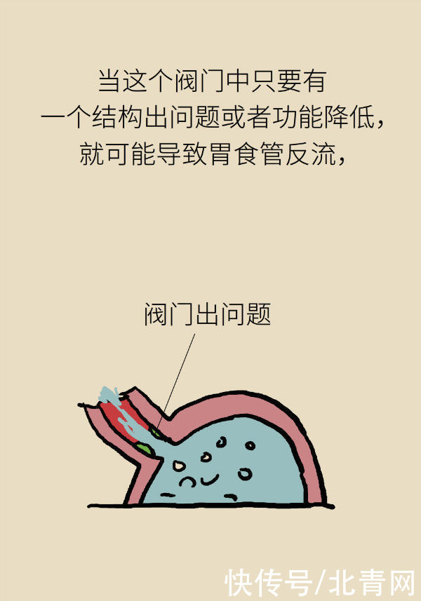 养胃|喝稀饭能养胃?警惕胃酸反流胃更烧