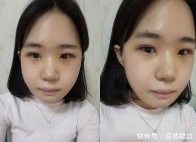 小脸确实更可爱,看完整容过程,只觉得满屏的疼痛