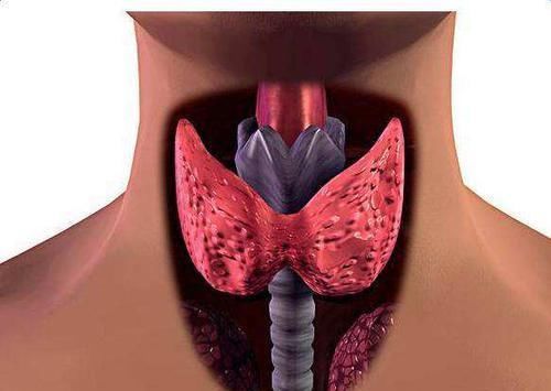 结节|有了“甲状腺结节”,多留心3个方面,可能会避免病情恶化