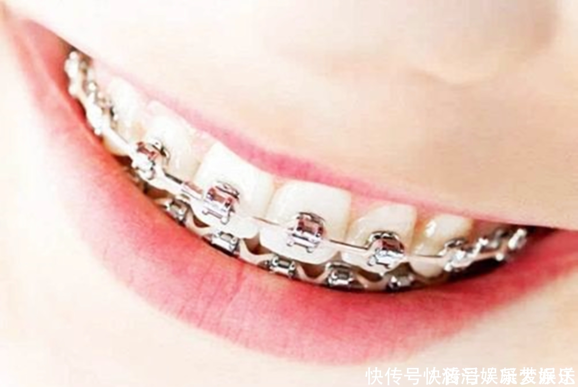 恒牙|好不容易等到宝宝换牙期,新牙却长歪了医生家长无知惹得锅