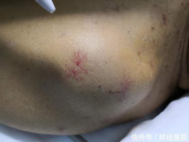 身体|养肝“冠军”并非苦瓜,经常吃,肝更有活力,身体显年轻