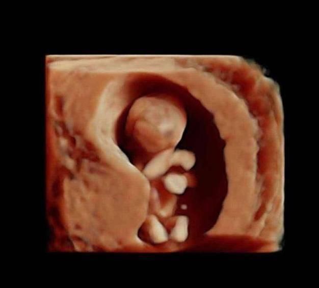 性别|胎儿从卵泡到性别形成,17张图片清晰诠释,男宝女宝看得很清楚