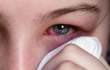 迹象|“肝不干净”,眼睛会“说话”,若眼睛有3种“迹象”,肝病来临