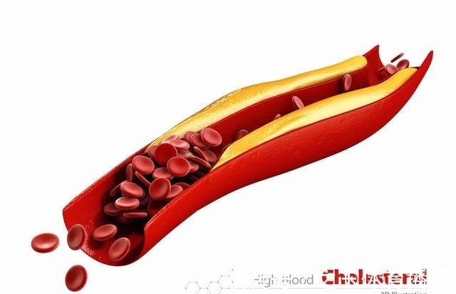 血液|血脂高的人不用怕,常吃3菜,多喝1水,清扫血液垃圾,血液不粘稠