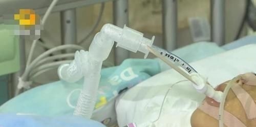 正餐|一家四口吃完饭,2岁弟弟和3岁哥哥相继身亡,医生说出原因太揪心