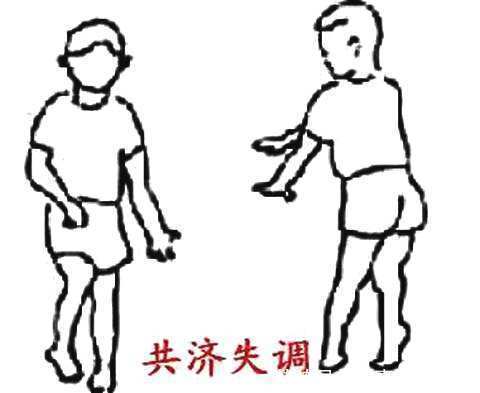 小脑萎缩的形成原因有哪些?