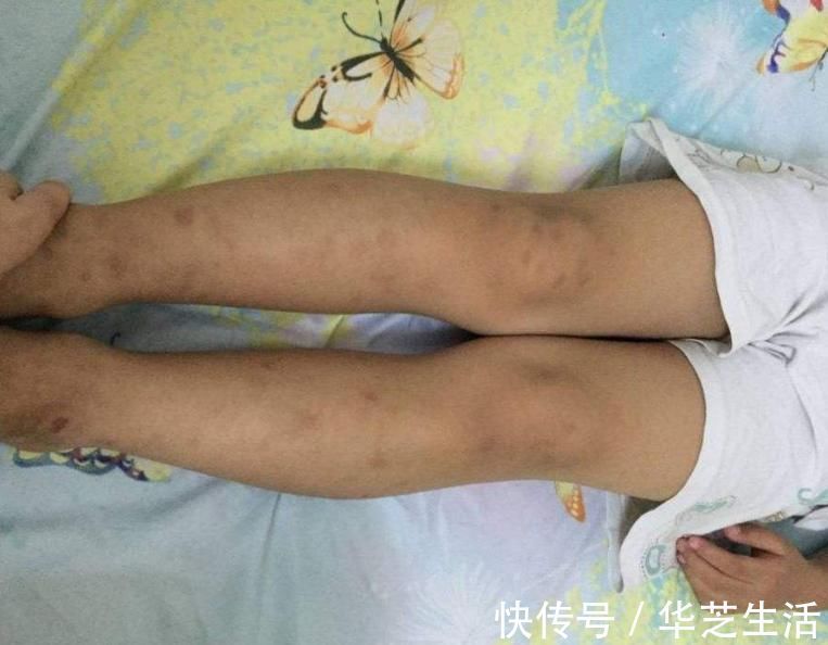 孩子|冬季到来,孩子进入猛长期,督促孩子做好3件事,身高猛增15公分