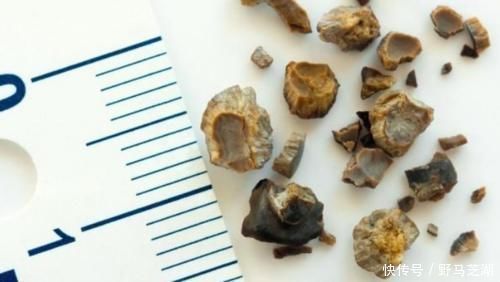 华子|水喝多了尿就多?肾功能正常的人,多长时间把水变成尿?