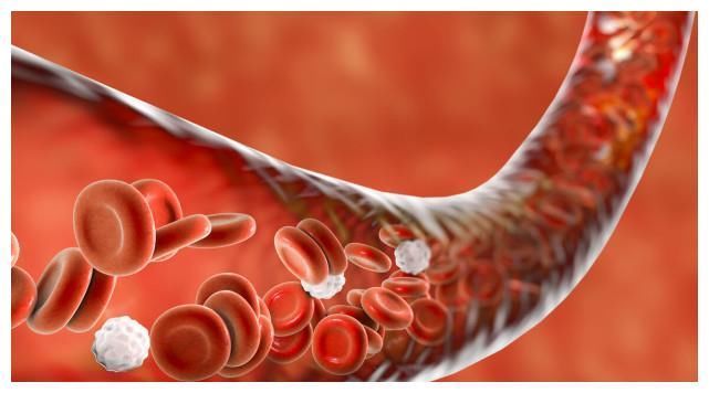 甘油三酯|49岁男子坚持3件事，甘油三酯从6.4降到1.6，血管通透头不晕了