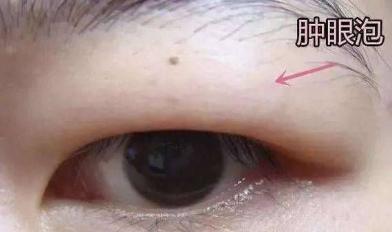 有这3种眼型的女生,基本与女神颜值无缘了,很多人都是第1种