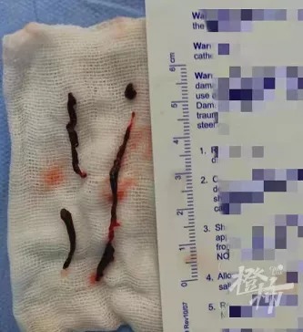 老奶奶|杭州90多岁老太太突发脑梗,原因竟是炒股时太激动了……