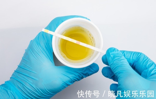 降尿酸|一种食物是“降酸王”,隔三差五吃一回,降尿酸,痛风悄悄好了