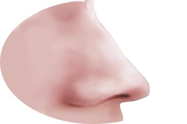 鼻子两侧的鼻翼部位，黑头总是很顽固，教你不用暴力也可轻松去除