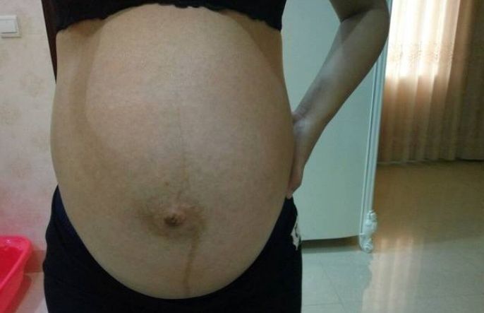 孕妇的“肚量”有多大一张图告诉你答案孕妇的内脏都被挤没了