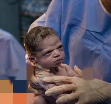 小动作|我就是不哭!”剖腹产宝宝“眼神杀”太霸气,网友:是个狠人