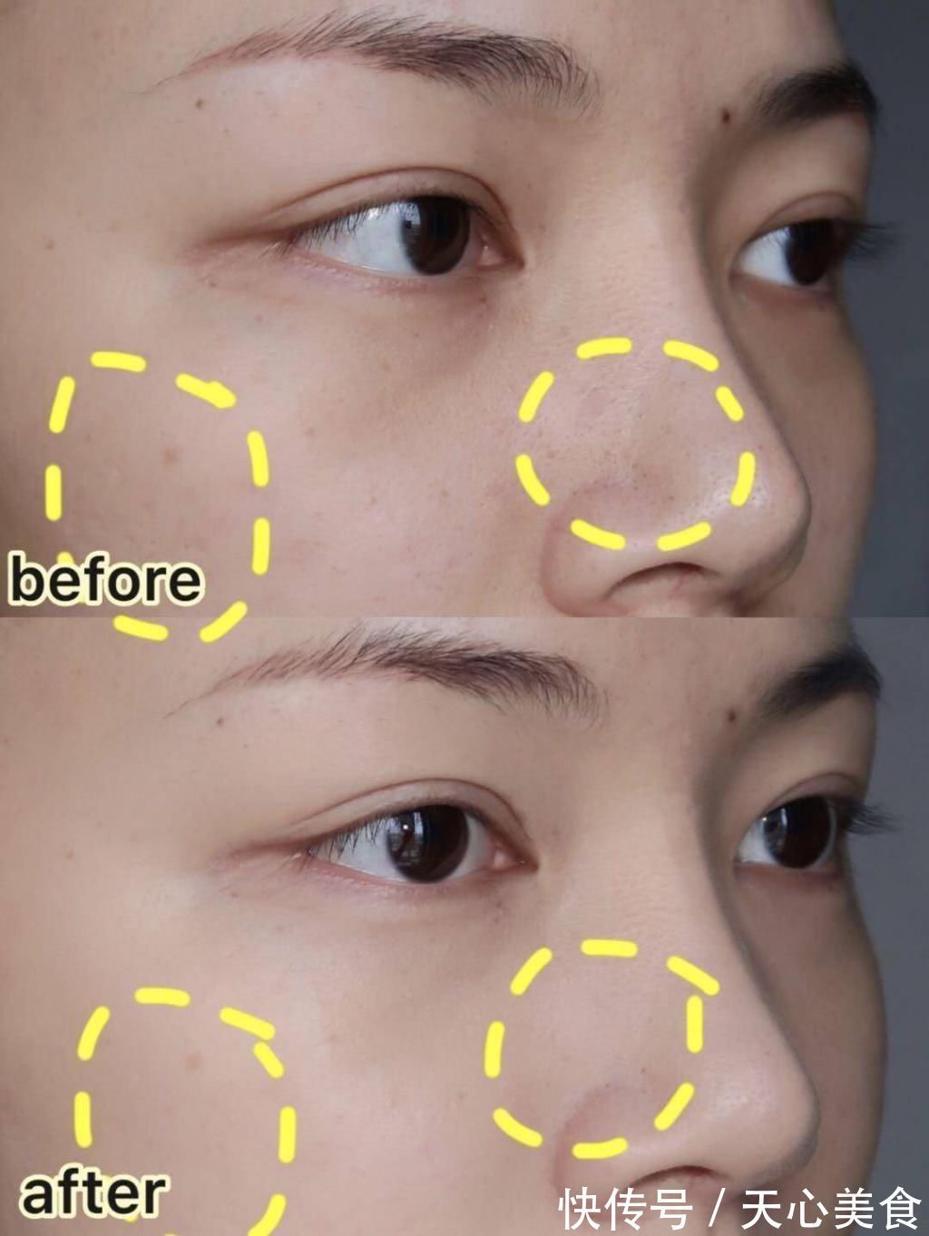 毛孔|美丽零负担,夏日当前,不妨为你的肌肤减减压