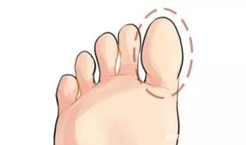 低头摸脚,百病治好,很多病在脚上都有开关,只是你不知道!