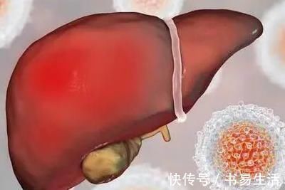 毒素|身上出现“二痒一痛”,要尽早重视,不要拖延,以免拖出肝病!
