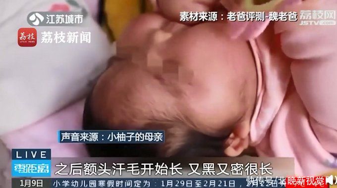 健康女婴用抑菌霜变大头娃娃，还全身长汗毛？涉事企业已停止生产