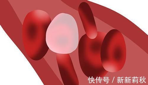 睡眠质量|血脂超标的人，医生：2个降血脂的方法，合理降脂，预防动脉硬化