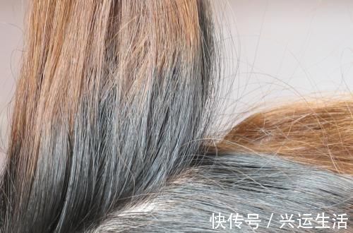 皮肤癌|头发变白爱染发,虽减龄、显年轻,但是可能会引发皮肤疾病