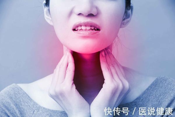 反流性食管炎|喉咙不舒服、有异物感除了咽炎,这3个因素也别忽视,需了解