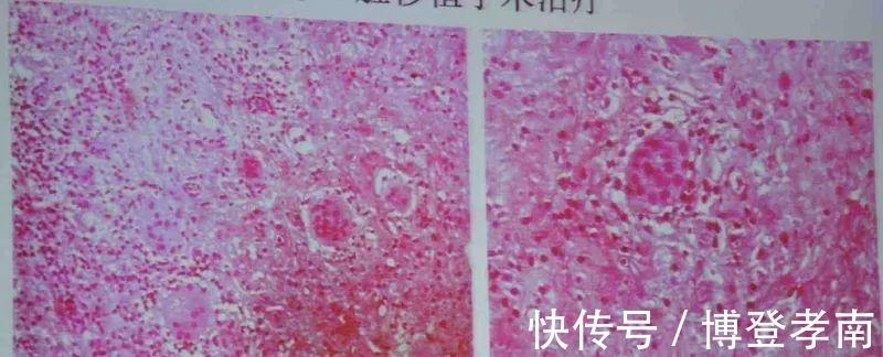 母亲|短短一夜,母亲痛失两子,都是家长的自以为是“害”了孩子