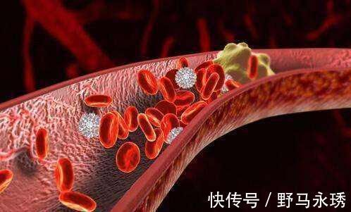 清洁工|它是血管“清洁工”,坚持每天吃一点,助疏通血管,身体健康