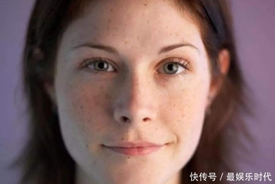 脸部|最伤女性皮肤的3件事,件件都会让黑色素沉淀,还容易显老!