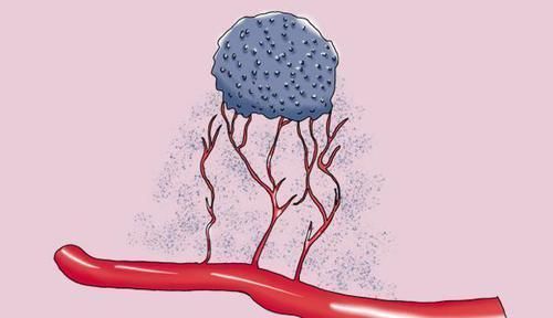 医生|癌细胞是如何生长繁殖的?吃肉会加速生长?医生告知真相