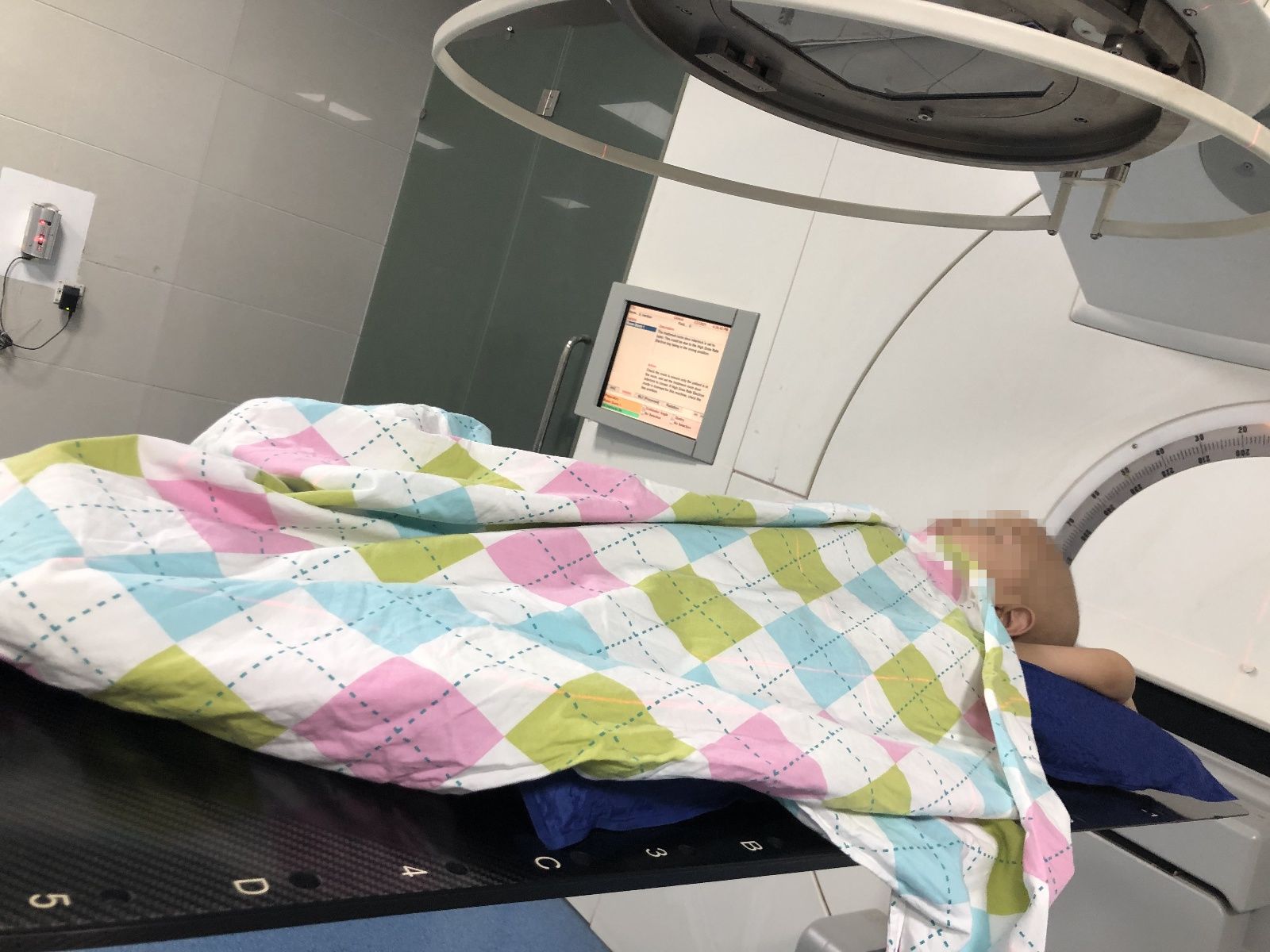 李宝宝|我院放疗中心儿童肿瘤放疗为患儿生命续航