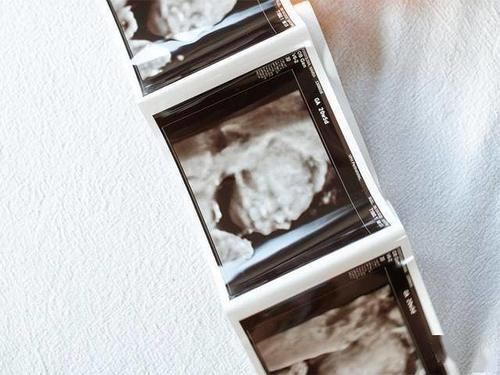 dn产检正常,生下唐氏儿,我可以起诉医院吗?能胜利吗?