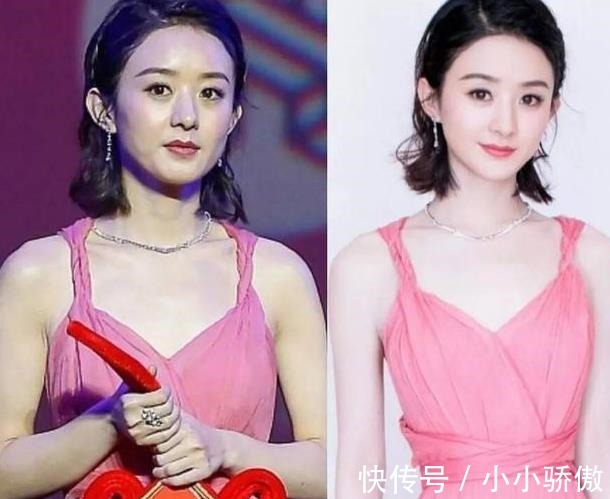精准强脉冲光 每个都有变美的权利，那么哪些医美项目你都了解吗！