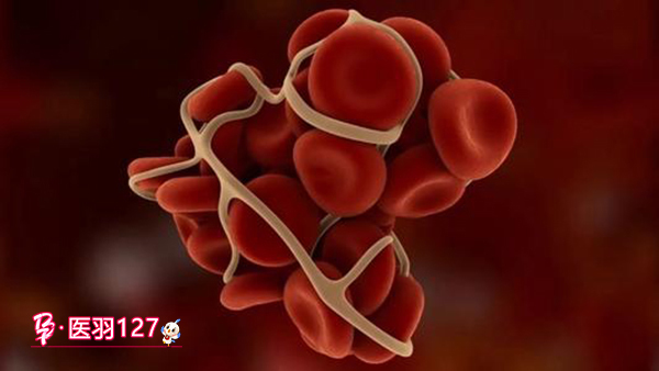 50%机率为|血友病可以通过第三代试管婴儿避免遗传吗?成功率有多高?