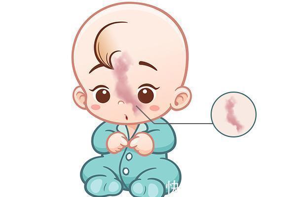 行为|贝安健康:孕期以下行为,容易让“胎记”找上宝宝。