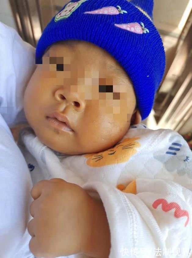 小君泳|“00后”妈妈割肝救子 华西ICU长大的“黄金”宝贝出院了