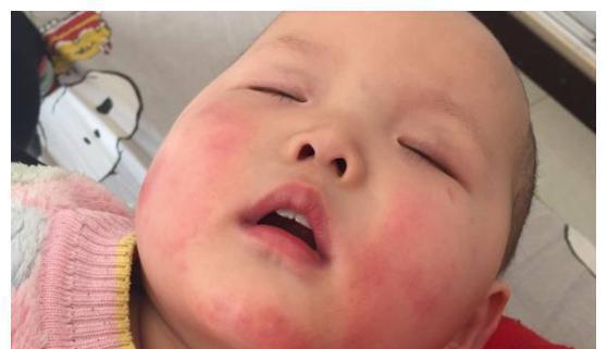 过敏原|辅食鸡蛋多大孩子可以吃?新手爸妈要先了解,吃不对容易坑娃!