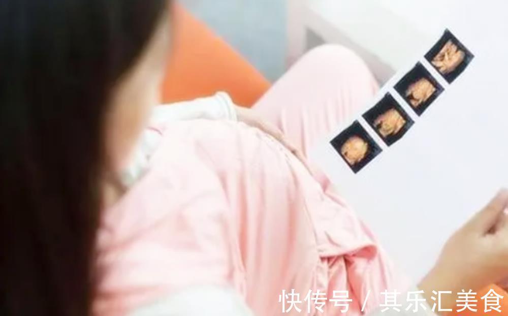 宝宝|四维彩超背后隐藏的几个“误区”，孕妈别再傻傻相信了，真没必要
