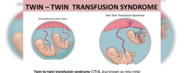 胎儿|腹中胎儿对镜头挥手,其实是求救讯号,医生脸色大变进行紧急手术