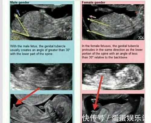 孕吐|孕期头4个月，定型的不止胎儿性别，还有这“三物”，孕妇要留心