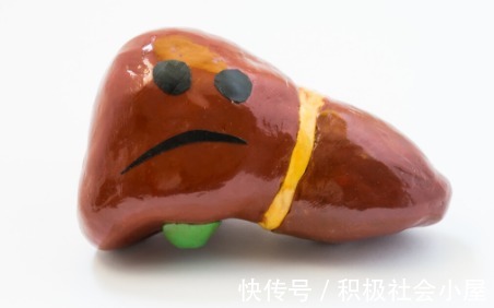 高脂血症|53岁阿姨患高血脂,半年内又被查出肝病,就是没重视这三件事惹的祸