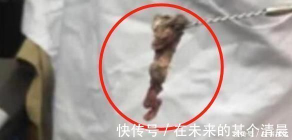 鼻腔|3岁女儿浑身“恶臭”洗不掉,送医检查后,结果让妈妈现场作呕
