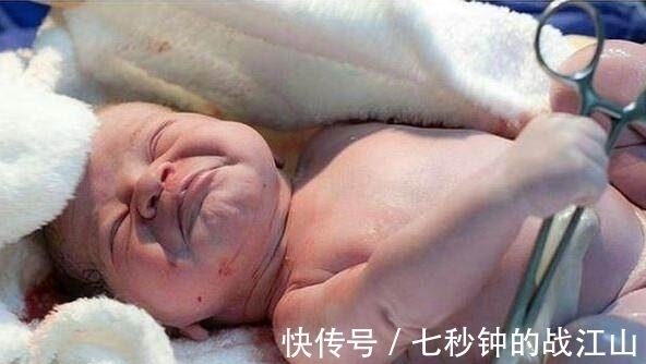 剖腹|刚剖腹出来的宝宝伸手抓住医生的剪刀,不让剪断脐带!