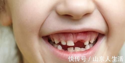 攻略|如果你的宝宝正在换牙,那么这份攻略你就得仔细看看了